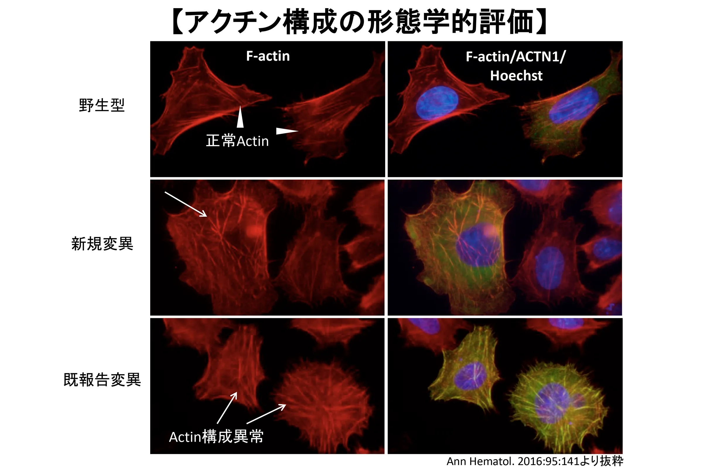 免疫・アレルギー・感染部門／研究内容